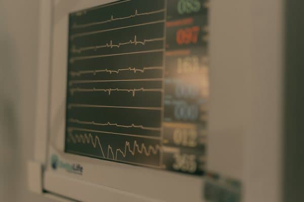 ECG & X-ray at home